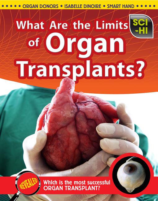 What Are the Limits of Organ Transplants?